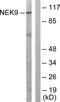 NIMA Related Kinase 9 antibody, LS-C118006, Lifespan Biosciences, Western Blot image 