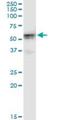 Hexokinase Domain Containing 1 antibody, H00080201-M05, Novus Biologicals, Immunoprecipitation image 