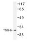 TNF Alpha Induced Protein 6 antibody, AP01235PU-N, Origene, Western Blot image 