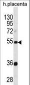 Tektin 3 antibody, LS-C156204, Lifespan Biosciences, Western Blot image 