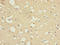 Coatomer Protein Complex Subunit Zeta 1 antibody, LS-C396400, Lifespan Biosciences, Immunohistochemistry paraffin image 