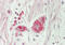 Branched Chain Keto Acid Dehydrogenase Kinase antibody, ARP52131_P050, Aviva Systems Biology, Immunohistochemistry paraffin image 