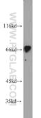 Intraflagellar Transport 81 antibody, 10604-2-AP, Proteintech Group, Western Blot image 