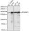 Eukaryotic Translation Initiation Factor 4E Nuclear Import Factor 1 antibody, LS-C750148, Lifespan Biosciences, Western Blot image 