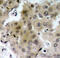Kinase Insert Domain Receptor antibody, MBS128501, MyBioSource, Immunohistochemistry paraffin image 