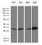 Proteasome Subunit Alpha 7 antibody, LS-C795414, Lifespan Biosciences, Western Blot image 