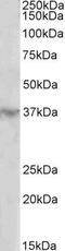 Homeobox D12 antibody, PA5-37868, Invitrogen Antibodies, Western Blot image 