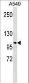 Lysyl Oxidase Like 2 antibody, LS-C165845, Lifespan Biosciences, Western Blot image 