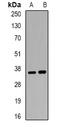 Acid Phosphatase 5, Tartrate Resistant antibody, orb377892, Biorbyt, Western Blot image 