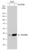 Acyl-CoA Dehydrogenase Short/Branched Chain antibody, NBP2-15237, Novus Biologicals, Western Blot image 