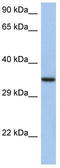 HORMA Domain Containing 2 antibody, TA338865, Origene, Western Blot image 