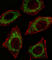 Aldehyde Dehydrogenase 2 Family Member antibody, abx027970, Abbexa, Western Blot image 