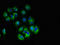 Calcium Voltage-Gated Channel Auxiliary Subunit Gamma 3 antibody, LS-C677363, Lifespan Biosciences, Immunofluorescence image 