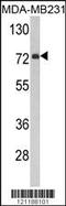 Flavin Containing Dimethylaniline Monoxygenase 3 antibody, 62-528, ProSci, Western Blot image 