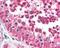 Hepatitis A Virus Cellular Receptor 1 antibody, ab78494, Abcam, Immunohistochemistry paraffin image 