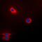 Ubiquitin Conjugating Enzyme E2 I antibody, orb214712, Biorbyt, Immunofluorescence image 