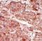 Hexokinase 3 antibody, LS-C101269, Lifespan Biosciences, Immunohistochemistry paraffin image 