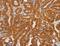 TNF Receptor Superfamily Member 8 antibody, LS-C403034, Lifespan Biosciences, Immunohistochemistry paraffin image 
