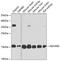 NADH:Ubiquinone Oxidoreductase Subunit B5 antibody, 15-707, ProSci, Western Blot image 