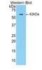 Complement Factor B antibody, LS-C372869, Lifespan Biosciences, Western Blot image 