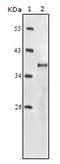 Insulin receptor antibody, AM06175SU-N, Origene, Western Blot image 