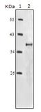 Insulin Like Growth Factor 1 Receptor antibody, AM06175SU-N, Origene, Western Blot image 