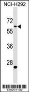 Amyloid Beta Precursor Protein Binding Family A Member 3 antibody, 60-236, ProSci, Western Blot image 