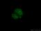 Paired Like Homeobox 2B antibody, 25276-1-AP, Proteintech Group, Immunofluorescence image 