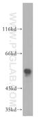 RAD9 Checkpoint Clamp Component A antibody, 13035-1-AP, Proteintech Group, Western Blot image 