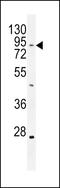 TBC1 Domain Family Member 14 antibody, 55-544, ProSci, Western Blot image 