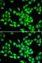 Protein-L-Isoaspartate (D-Aspartate) O-Methyltransferase antibody, LS-C334874, Lifespan Biosciences, Immunofluorescence image 