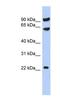 Tigger Transposable Element Derived 3 antibody, NBP1-70725, Novus Biologicals, Western Blot image 