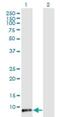 Translocase Of Inner Mitochondrial Membrane 8 Homolog B antibody, H00026521-M15, Novus Biologicals, Western Blot image 