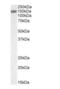 RNA Binding Motif Protein 20 antibody, NBP2-27509, Novus Biologicals, Western Blot image 