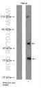 TAR DNA Binding Protein antibody, 22309-1-AP, Proteintech Group, Western Blot image 