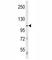 Unc-51 Like Autophagy Activating Kinase 1 antibody, F51530-0.4ML, NSJ Bioreagents, Western Blot image 