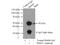 Betaine--Homocysteine S-Methyltransferase antibody, 15965-1-AP, Proteintech Group, Immunoprecipitation image 