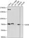 Growth Arrest Specific 6 antibody, GTX64470, GeneTex, Western Blot image 