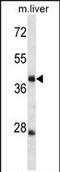 Tripartite Motif Containing 44 antibody, PA5-72058, Invitrogen Antibodies, Western Blot image 