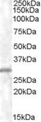 Charged Multivesicular Body Protein 5 antibody, EB06716, Everest Biotech, Western Blot image 