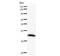 DEAD-Box Helicase 5 antibody, LS-C342498, Lifespan Biosciences, Western Blot image 