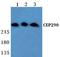 Centrosomal Protein 290 antibody, A01894, Boster Biological Technology, Western Blot image 