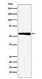Cystathionine-Beta-Synthase antibody, M00130-1, Boster Biological Technology, Western Blot image 