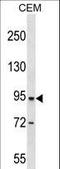 Dipeptidyl Peptidase 4 antibody, LS-C159486, Lifespan Biosciences, Western Blot image 