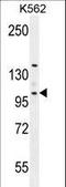 Villin Like antibody, LS-C160526, Lifespan Biosciences, Western Blot image 