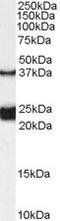 Galanin Receptor 1 antibody, PA5-18629, Invitrogen Antibodies, Western Blot image 