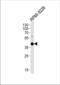 CD38 Molecule antibody, TA324750, Origene, Western Blot image 