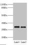 Proteasome Activator Subunit 1 antibody, LS-C676324, Lifespan Biosciences, Western Blot image 