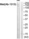 c-met antibody, abx013012, Abbexa, Western Blot image 