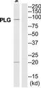Plasminogen antibody, TA314352, Origene, Western Blot image 